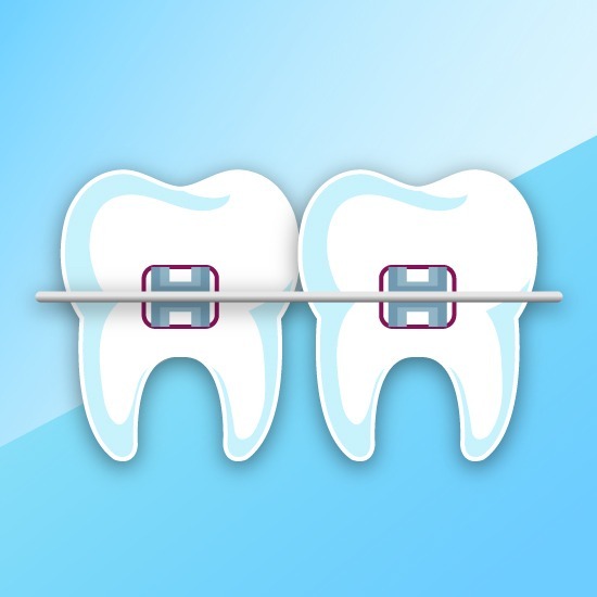 orthodontics - Dental Villa