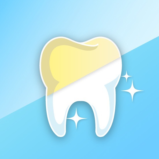 การฟอกสีฟัน การฟอกสีฟัน  ฟอกฟันขาว  ฟอกสีฟัน บางแสน ชลบุรี  คลินิกทำฟัน  หมอฟันบางแสน  คลินิกทันตกรรมเด็นทัลวิลลา 