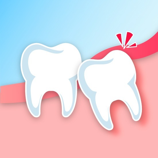 การผ่าฟันคุด - คลินิกทันตกรรมเด็นทัลวิลลา
